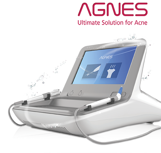 AGNES The Ultimate Solution for Acne